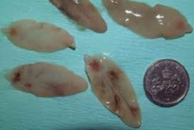 There there are proper labelling of this diagram. Lifecycle Of Liver Fluke Scops