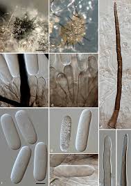 Image result for Chlorophytum macrosporum