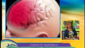 Que Hago Si Mi Hijo Se Golpea En La Cabeza Youtube