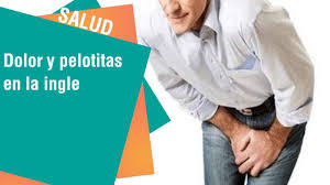 Descubra Por Que Aparecen Esas Pelotitas En La Ingle Youtube