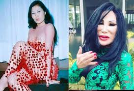 Pues seux moriría al poco tiempo de hacer supuestas declaraciones sobre las hijas de lyn. Asi Era Lyn May Antes Del Tratamiento Que Le Transformo La Cara Fotos