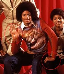 Michael Jackson Photo The Vitiligo Proof Michael Jackson Michael Jackson Images Micheal Jackson