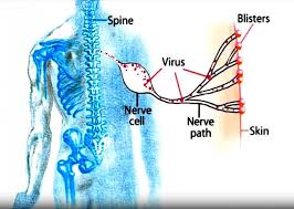A small signboard outside the office of a lawyer or doctor, e.g. Preventing Shingles Nih News In Health