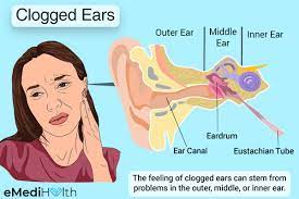 Clogged Ears: Causes, Symptoms, And Treatment Options