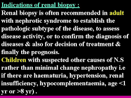 O membranous (most common in adults) o minimal change disease (most common in children) o history in nephrotic syndrome · presenting complaint o oedema o foaming urine o thrombotic complication: Nephrotic Syndrome Lecture6 Hazem K Alkhafaji Dm Ficms