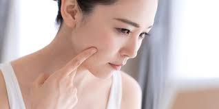 Dengan berbagai bahan luar biasa yang terkandung di dalamnya, madu dapat oleskan madu pada area wajah secara merata khususnya pada beberapa area wajah yang terdapat flek hitam. 9 Cara Menghilangkan Flek Hitam Di Wajah Secara Alami Halaman All Kompas Com