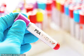 25.09.2017 · symptoms of prostate cancer in menyoyo tv viral videos: The Race To Beat Prostate Cancer With Test Is Right For You Daily Mail Online