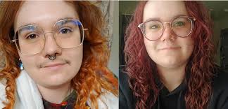 American Academy of Pediatrics Sued Over Controversial 'Gender-Affirming  Care' Guidance