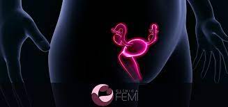Utero Retrovertido Clinica Femi