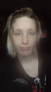 Pregnancy and mom skin care tips needed