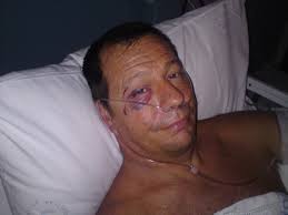 Bite Club was set up by Dave Pearson after he was attacked by a shark at  Crowdy Head in 2011.