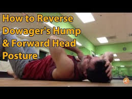 How To Reverse Dowager S Hump Forward Head Posture Aaron Alexander Align Method Youtube Forward Head Posture Neck Exercises Dowager Hump