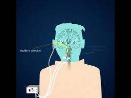 University Of Michigan Research Shows An Experimental Device Could Help Quiet The Phantom Sounds Of Tinnitus By Ta In 2020 Tinnitus Symptoms Tinnitus Remedies The Cure