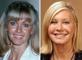 Pin On Types De Chirurgie Plastique