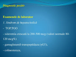 Raport tgo/tgp > 2, cu tgp <300 u/l indica hepatita alcoolica. Hepatita ViralÄ A BoalÄ Infecto ContagioasÄ AcutÄ AutolimitatÄ Ppt Katebasma
