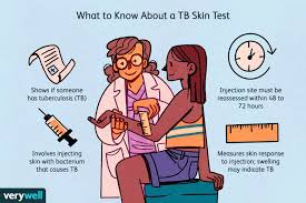 Image result for Tuberculosis Screening