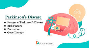 Parkinson S Disease 5 Stages Risk Factors Prevention Gene Therapy