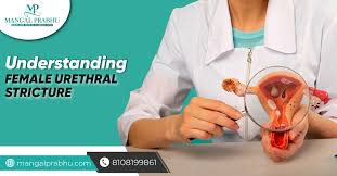 Image result for Urethral Stricture