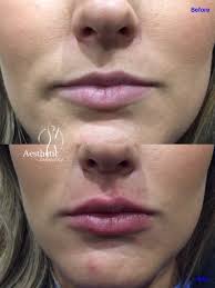 Wichita, kansas metropolitan area500+ connections. Before And After Aesthetic Solutions