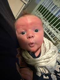 Wilson is set to start receiving his cells in about an hour! We will be  praying over his cells in the next little bit!