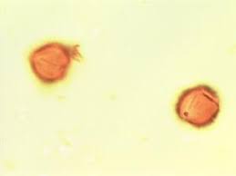 Image result for Xeroderris