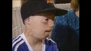 For Beauty Passed Away... A Continuation