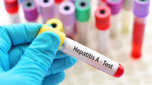 The virus is one of several types of hepatitis viruses that cause inflammation and affect your liver's ability to function. Hepatitis A Ansteckung Symptome Vorbeugung Gesund Bund De