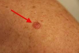 Pin On Skin