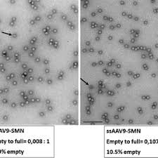 Image result for Silver Grey 1995 AAV