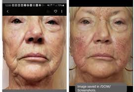 Silver Screen Beauty