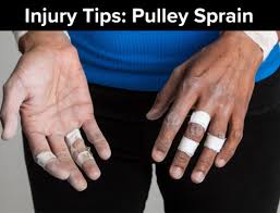 Usually ships within 3 to 5 weeks. Pulley Protection Splint The Climbing Doctor