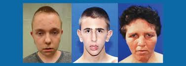 Rare Truncating Mutations Linked with Autism