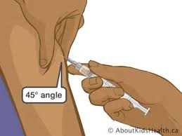 Image result for Subcutaneous Injection