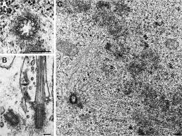 Image result for Centrostigma