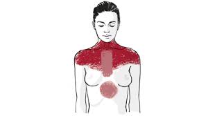 Herzinfarkt Bei Frauen Symptome Die Sie Kennen Sollten Herzstiftung