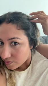 I’ve been using @Mielle Organics Rosemary oil for hair growth.  #postpartumhair #mielleorganics #nycmom #evelynlilybeth #momsoftiktok