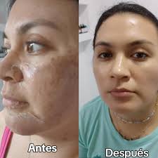 Lavadora automática de 18 kilos tina de acero inoxidable en buen estado  jala al cien entrego a domicilio y doy un mes de garantía barata