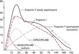 cardiac markers timeline chart myocardial infarction