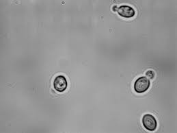 Image result for Buchnera candida