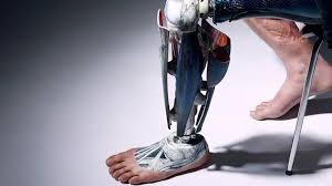 .we had to make him a new one, check out the smile on his face after he received his 21585 3d models found related to prosthetic leg designs. Prosthetics Meet The Man With 13 Legs Bbc Future