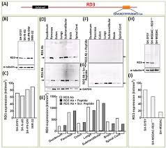 With bond ladders, you make a series of timed investments that enable you to collect interest throughout the year as a form of passive income. Retinal Degeneration Protein 3 Rd3 In Normal Human Tissues Novel Insights Scientific Reports