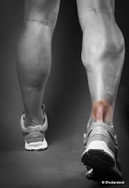 Cet article concerne l'expression « talon d'achille ». Mieux Comprendre Les Tendinopathies Calcaneennes Ou Achilleennes Lepape Info