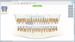 Dental Treatment Software