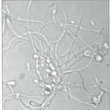 It is an optical microscope that uses light rays to produce a dark image against a bright background. Candida Guilliermondii Cmgb44 Cells Observed At Optic Microscope 40x Download Scientific Diagram