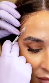 Microneedling is a procedure that uses a bunch of tiny needles to puncture the very first layer of skin. Medspa Palo Alto Medical Spa Bay Area