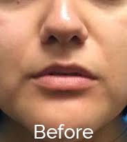 Dermatology & Skin Cancer Surgery Center