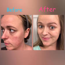 What's one skincare tip or routine change that's helped you feel more  confident in your skin?