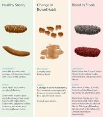 Image result for Blood in stool