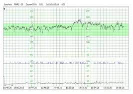 Ab wann ultraschall am bauch? Ctg Herztone Und Wehen Im Blick Schwangerinmeinerstadt