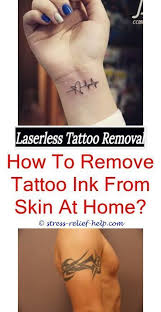 Pin On Tattoo Removal